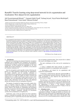 KartalOl: Transfer learning using deep neural network for iris
  segmentation and localization: New dataset for iris segmentation