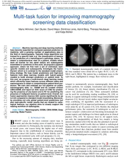 Multi-task fusion for improving mammography screening data
  classification