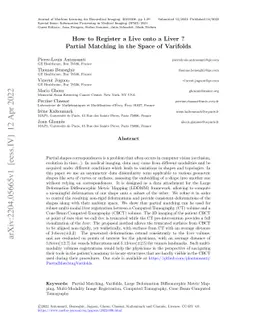 How to Register a Live onto a Liver ? Partial Matching in the Space of
  Varifolds