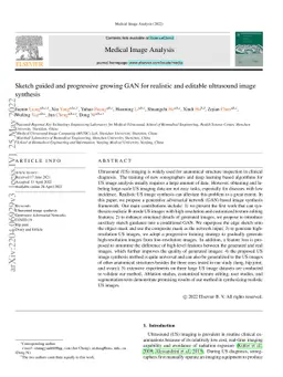 Sketch guided and progressive growing GAN for realistic and editable
  ultrasound image synthesis