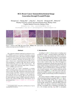 BCI: Breast Cancer Immunohistochemical Image Generation through Pyramid
  Pix2pix
