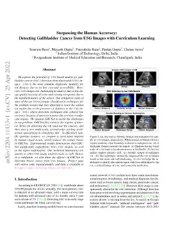 Surpassing the Human Accuracy: Detecting Gallbladder Cancer from USG
  Images with Curriculum Learning