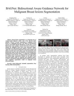 BAGNet: Bidirectional Aware Guidance Network for Malignant Breast
  lesions Segmentation