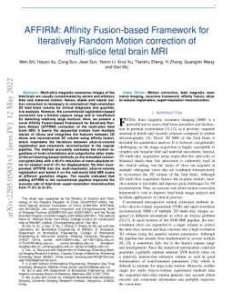 AFFIRM: Affinity Fusion-based Framework for Iteratively Random Motion
  correction of multi-slice fetal brain MRI