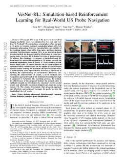 VesNet-RL: Simulation-based Reinforcement Learning for Real-World US
  Probe Navigation