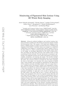 Monitoring of Pigmented Skin Lesions Using 3D Whole Body Imaging