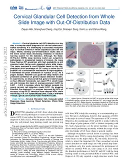 Cervical Glandular Cell Detection from Whole Slide Image with
  Out-Of-Distribution Data