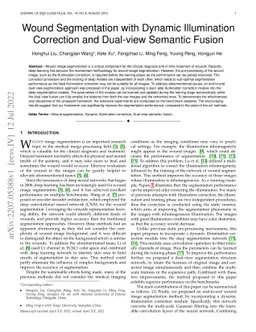 Wound Segmentation with Dynamic Illumination Correction and Dual-view
  Semantic Fusion