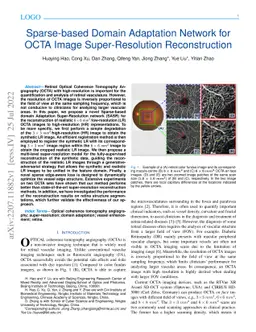 Sparse-based Domain Adaptation Network for OCTA Image Super-Resolution
  Reconstruction