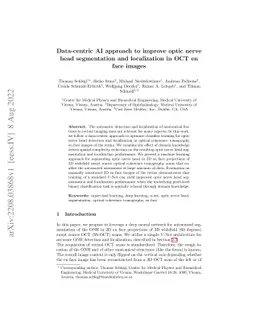 Data-centric AI approach to improve optic nerve head segmentation and
  localization in OCT en face images