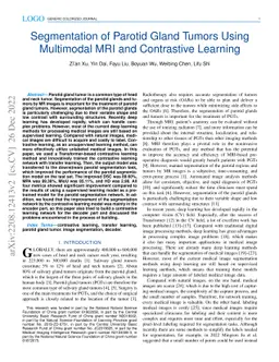 Segmentation of Parotid Gland Tumors Using Multimodal MRI and
  Contrastive Learning
