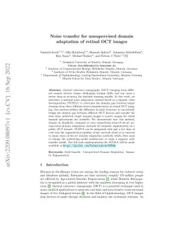 Noise transfer for unsupervised domain adaptation of retinal OCT images