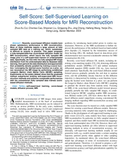 Self-Score: Self-Supervised Learning on Score-Based Models for MRI
  Reconstruction