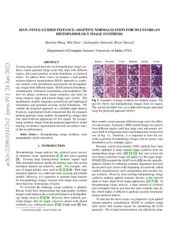 SIAN: Style-Guided Instance-Adaptive Normalization for Multi-Organ
  Histopathology Image Synthesis
