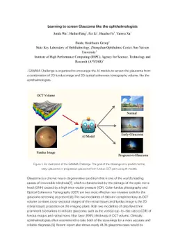 Learning to screen Glaucoma like the ophthalmologists