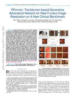 RFormer: Transformer-based Generative Adversarial Network for Real
  Fundus Image Restoration on A New Clinical Benchmark