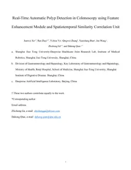 Real-time automatic polyp detection in colonoscopy using feature
  enhancement module and spatiotemporal similarity correlation unit