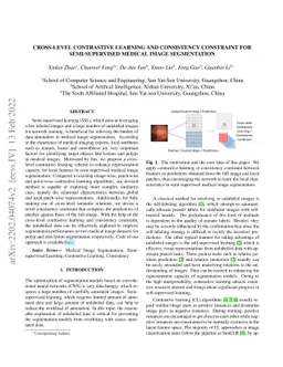 Cross-level Contrastive Learning and Consistency Constraint for
  Semi-supervised Medical Image Segmentation