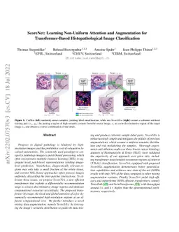 ScoreNet: Learning Non-Uniform Attention and Augmentation for
  Transformer-Based Histopathological Image Classification