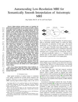 Autoencoding Low-Resolution MRI for Semantically Smooth Interpolation of
  Anisotropic MRI