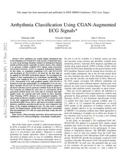 Arrhythmia Classification using CGAN-augmented ECG Signals