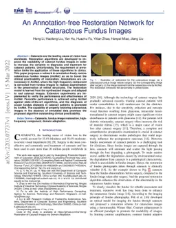 An Annotation-free Restoration Network for Cataractous Fundus Images