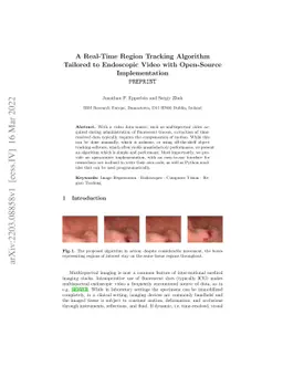 A Real-Time Region Tracking Algorithm Tailored to Endoscopic Video with
  Open-Source Implementation