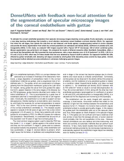 DenseUNets with feedback non-local attention for the segmentation of
  specular microscopy images of the corneal endothelium with guttae