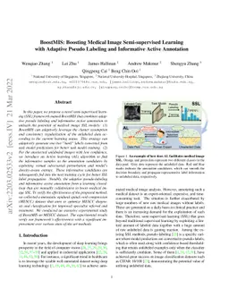 BoostMIS: Boosting Medical Image Semi-supervised Learning with Adaptive
  Pseudo Labeling and Informative Active Annotation