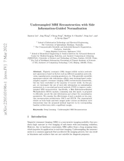 Undersampled MRI Reconstruction with Side Information-Guided
  Normalisation