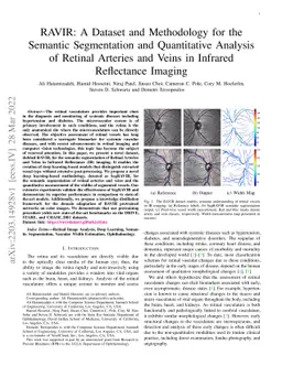 RAVIR: A Dataset and Methodology for the Semantic Segmentation and
  Quantitative Analysis of Retinal Arteries and Veins in Infrared Reflectance
  Imaging