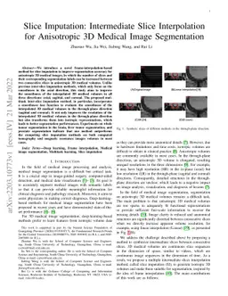 Slice Imputation: Intermediate Slice Interpolation for Anisotropic 3D
  Medical Image Segmentation