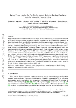 Robust deep learning for eye fundus images: Bridging real and synthetic
  data for enhancing generalization