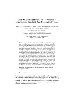 CoRe: An Automated Pipeline for The Prediction of Liver Resection
  Complexity from Preoperative CT Scans