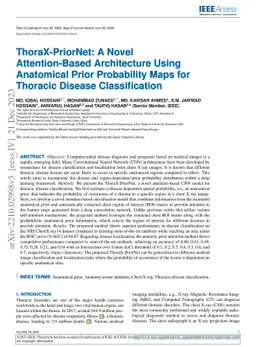 ThoraX-PriorNet: A Novel Attention-Based Architecture Using Anatomical
  Prior Probability Maps for Thoracic Disease Classification