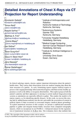 Detailed Annotations of Chest X-Rays via CT Projection for Report
  Understanding