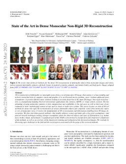 State of the Art in Dense Monocular Non-Rigid 3D Reconstruction