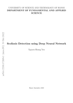 Scoliosis Detection using Deep Neural Network