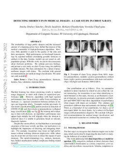 Detecting Shortcuts in Medical Images -- A Case Study in Chest X-rays