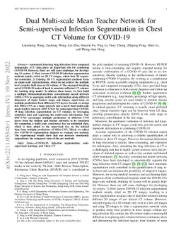 Dual Multi-scale Mean Teacher Network for Semi-supervised Infection
  Segmentation in Chest CT Volume for COVID-19