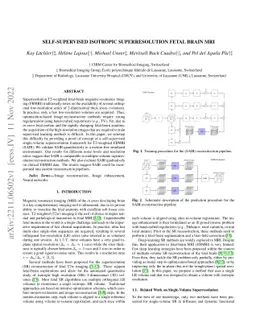 Self-Supervised Isotropic Superresolution Fetal Brain MRI