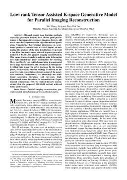 Low-rank Tensor Assisted K-space Generative Model for Parallel Imaging
  Reconstruction