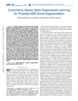 Uncertainty-Aware Semi-Supervised Learning for Prostate MRI Zonal
  Segmentation