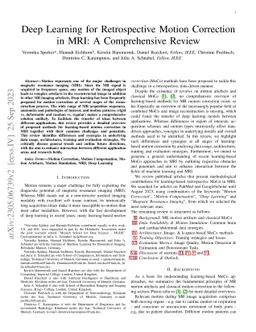 Deep Learning for Retrospective Motion Correction in MRI: A
  Comprehensive Review