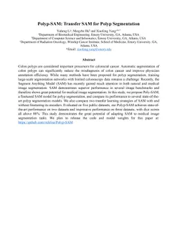 Polyp-SAM: Transfer SAM for Polyp Segmentation