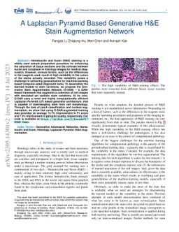 A Laplacian Pyramid Based Generative H&E Stain Augmentation Network