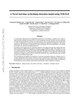 A Novel real-time arrhythmia detection model using YOLOv8
