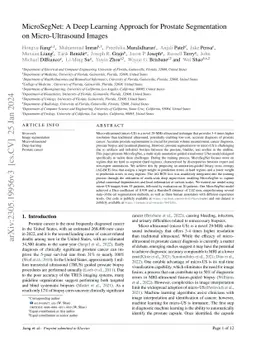 MicroSegNet: A Deep Learning Approach for Prostate Segmentation on
  Micro-Ultrasound Images