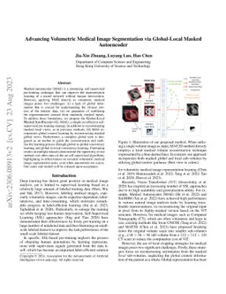 Advancing Volumetric Medical Image Segmentation via Global-Local Masked
  Autoencoder