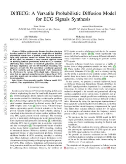 DiffECG: A Versatile Probabilistic Diffusion Model for ECG Signals
  Synthesis
